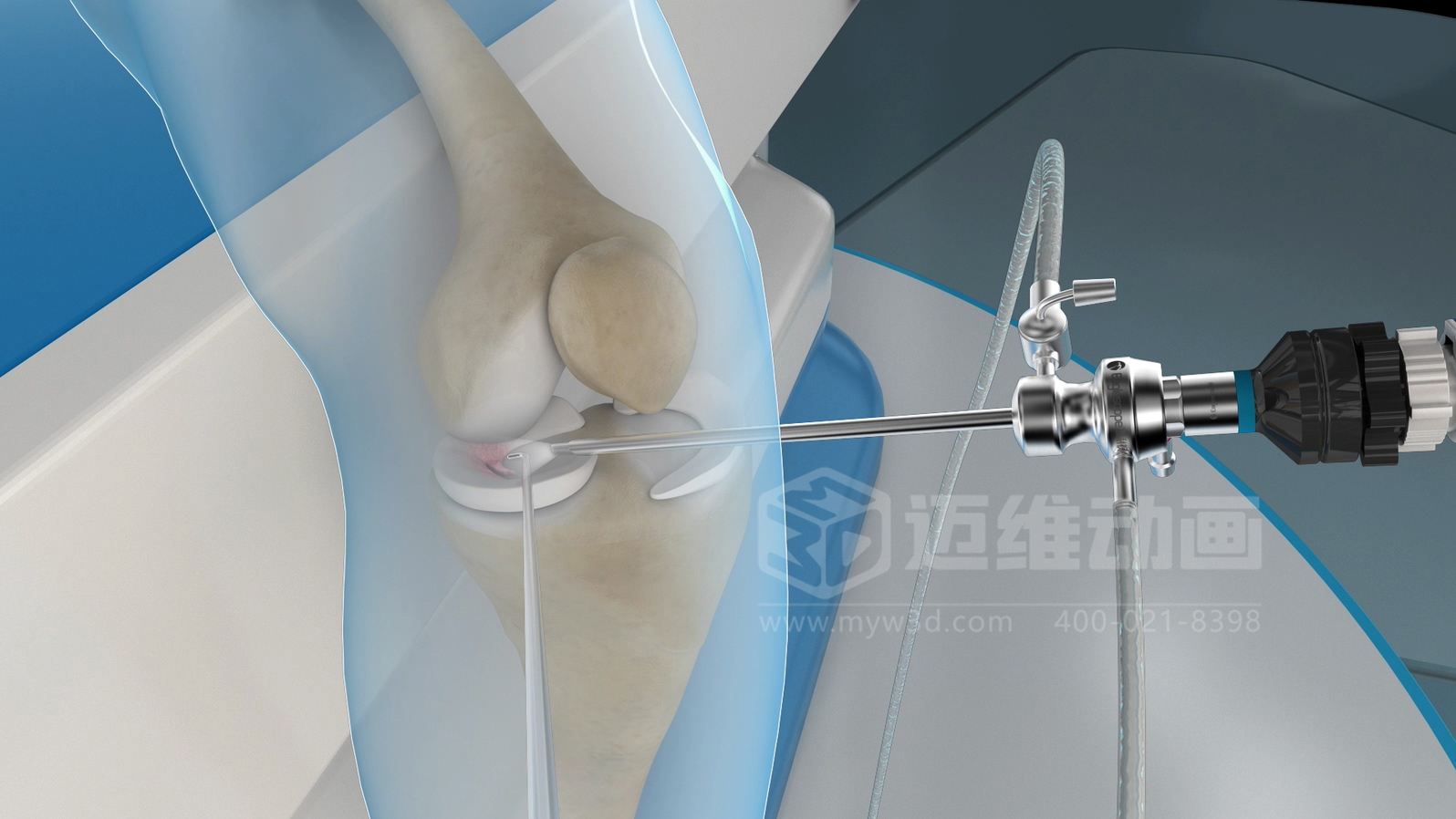 醫(yī)學(xué)手術(shù)三維動(dòng)畫(huà)制作公司哪家好？解碼上海邁維動(dòng)漫的醫(yī)學(xué)醫(yī)療3D可視化創(chuàng)新之路(圖1)