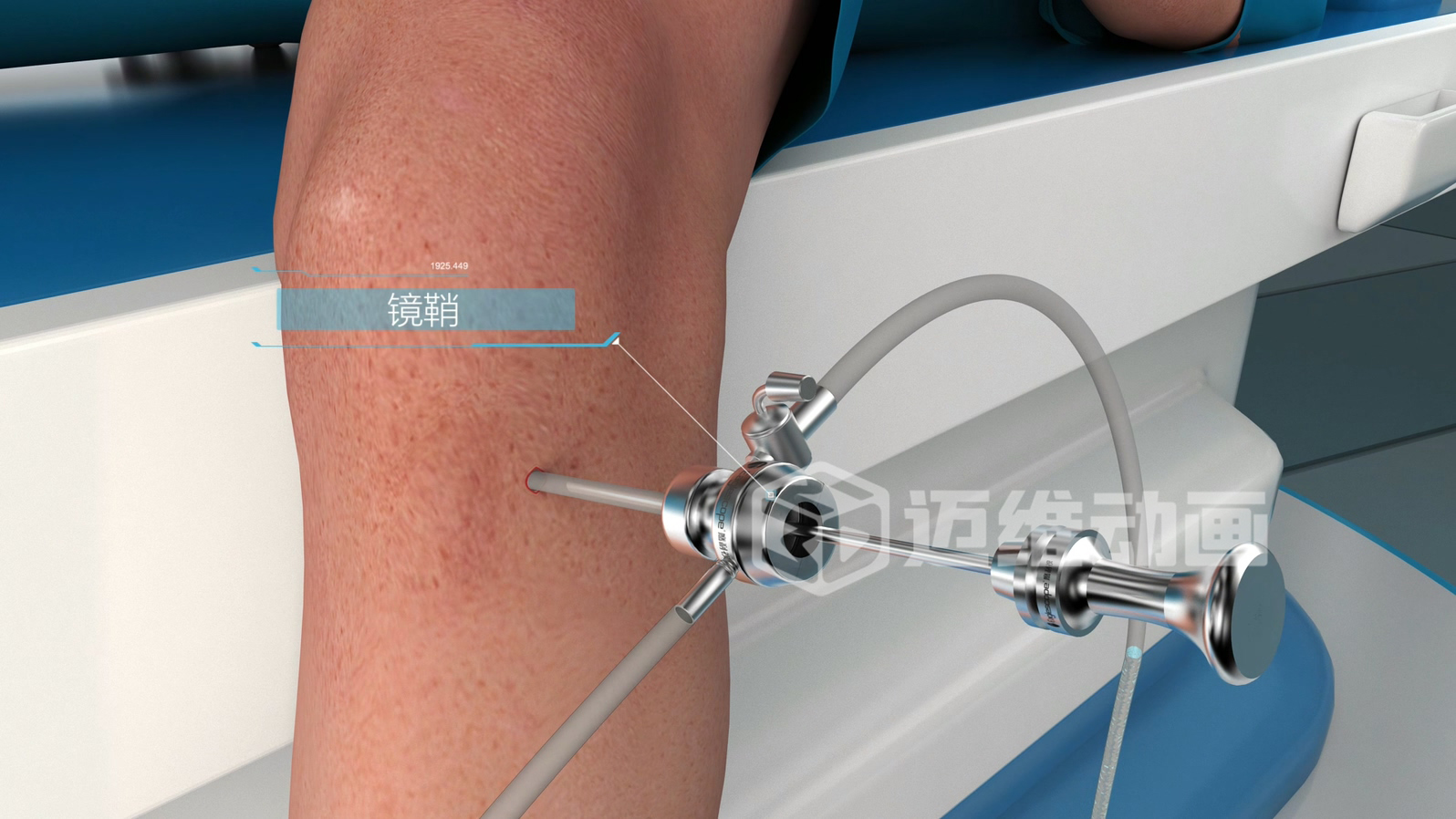 關(guān)節(jié)鏡手術(shù)三維動(dòng)畫